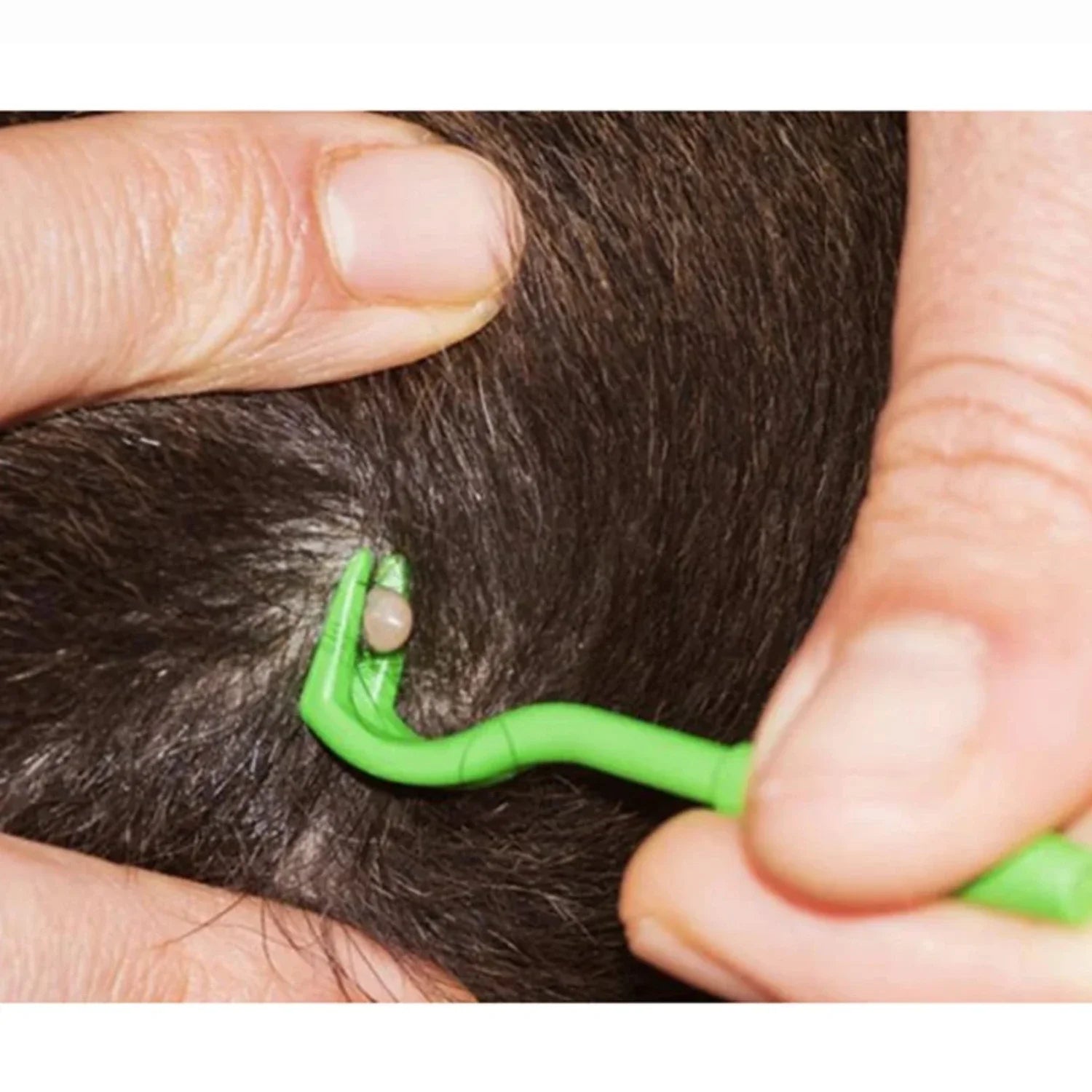 Tick Removal Tool Set for Dogs, Pets, and Humans